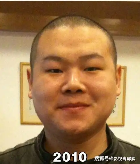 原创岳云鹏晒21年来的28张自拍照,曾经头发茂盛,最后一张像女人