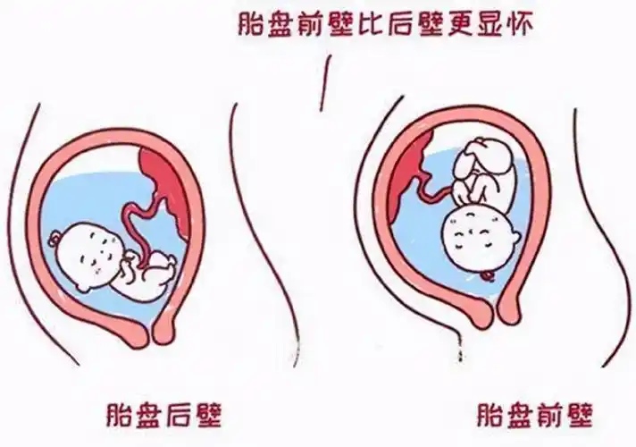 孕妈们显怀的程度,我们常见的胎盘位置只要有胎盘前壁和胎盘后壁两种