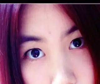 这种眼算四白眼么