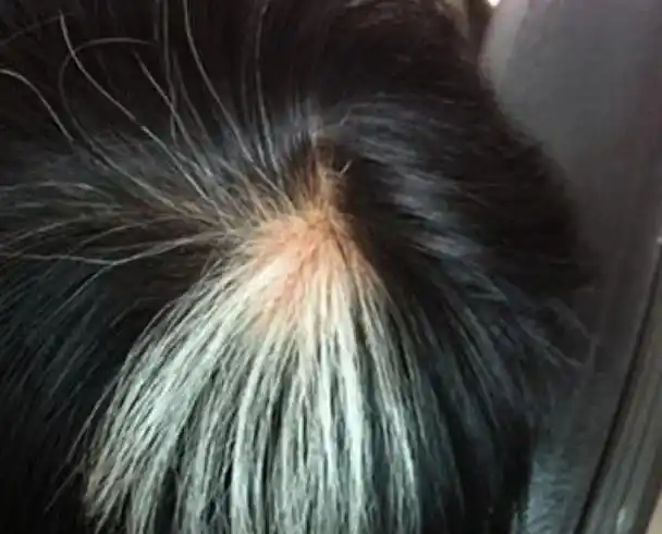 静雅!三个部位长白发最危险"引咎自责"-第1张图片-太白博客