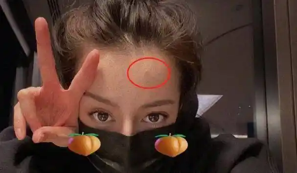 原创迪丽热巴晒照自称儿童意外暴露额上一颗痘浓眉大眼颜值精致