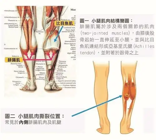小腿肌肉结构 我们的小腿肌肉分别由表层的腓肠肌(gastrocnemius)及