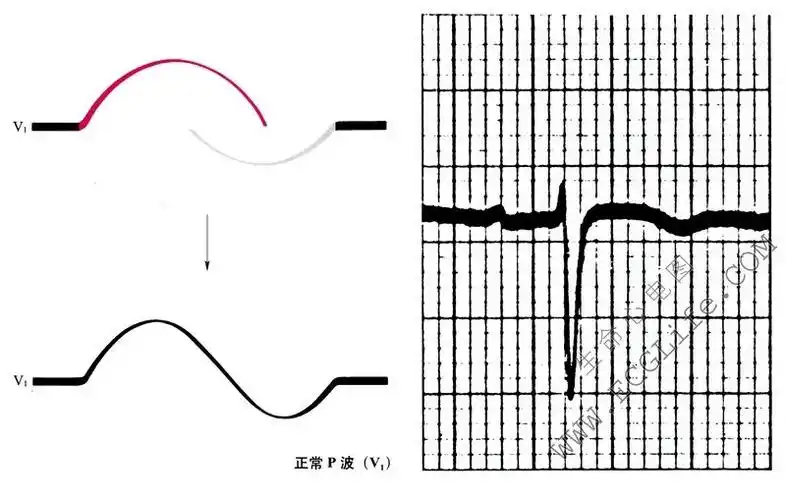 正常心电图p波