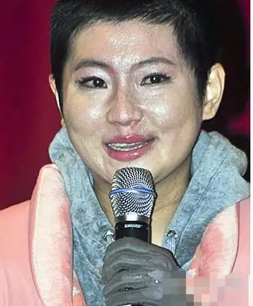 俞灏明火烧事件是怎么回事(揭秘俞灏明烧伤始末与现状)