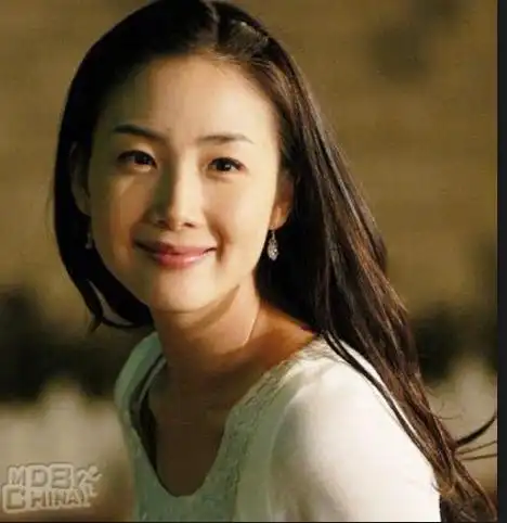 完全变脸的崔智友,让人不忍直视,这完全是整容后遗症啊!