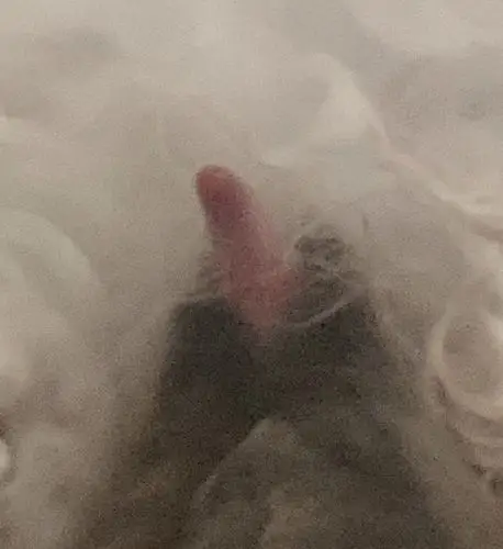 有图慎入这个丁丁正常吗问题已解决