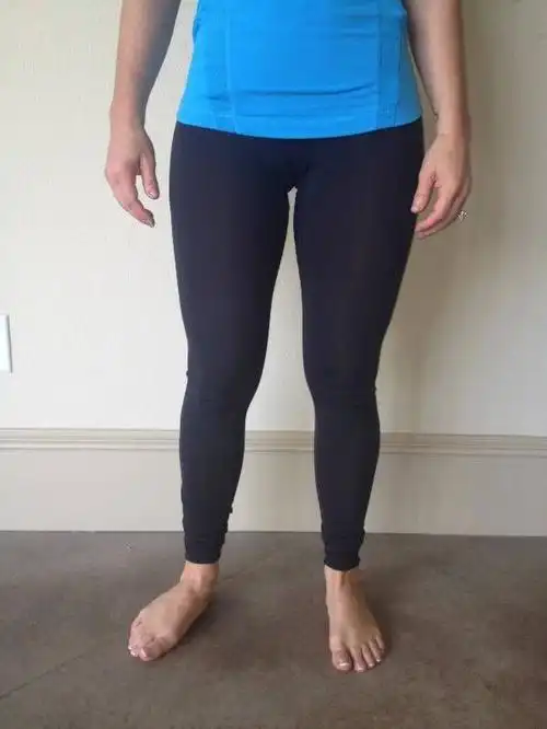 如何纠正走路外八字脚通过训练如何纠正外八字