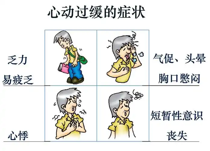 一文了解心动过缓与起搏器_心动过缓_疾病介绍_治疗方法_介绍_治疗