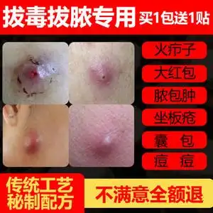 火疖子拔毒膏贴图片