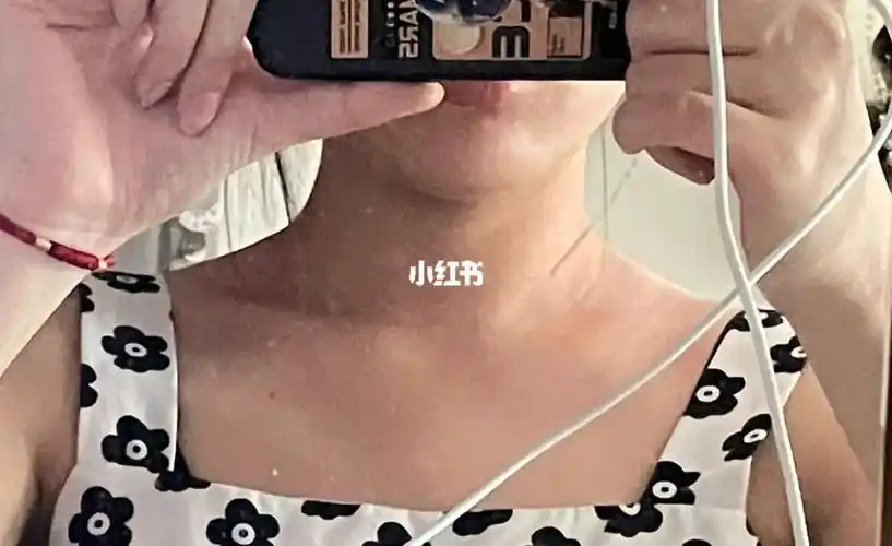 我的肩膀一高一低,锁骨也不一样,一个平的,一斜的,我是不是有什么问题