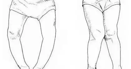 小孩的腿简笔画