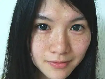 再见了"色斑",3款好物从内到外调养皮肤,皮肤白嫩得像小姑娘