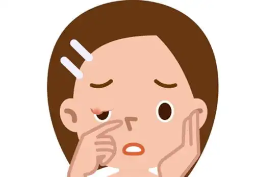 麦粒肿与霰粒肿的区别?