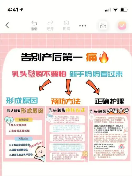 预防乳头皲裂0569看这73篇就够了