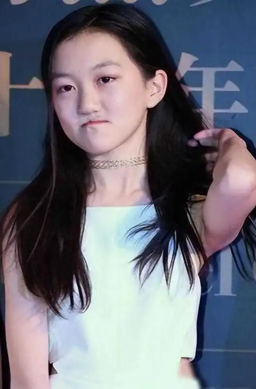 王菲花百万为女儿治疗唇裂如今嘴是治好了脸却越来越奇怪了