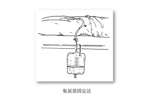 25                【操作步骤】剃去阴毛行导尿术