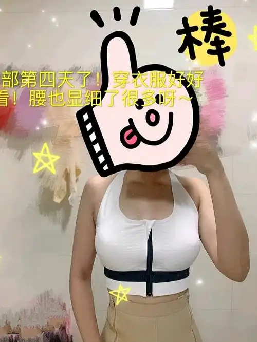 哈喽,今天是我做自体脂肪丰胸的第二个月了,终于感受到c罩杯的欢乐了.