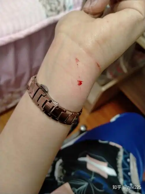 怎样拯救一个自残过的女生