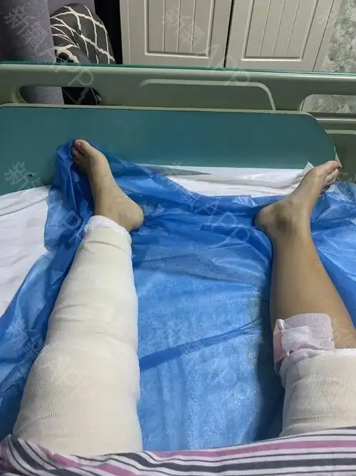 说说我的感受吧,现在的我插着尿管,下半身用绷带包裹_圈子-新氧美容