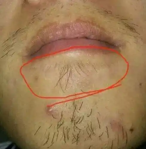 为什么我们身边几乎没有留胡子的男生,明明留对胡子man爆了