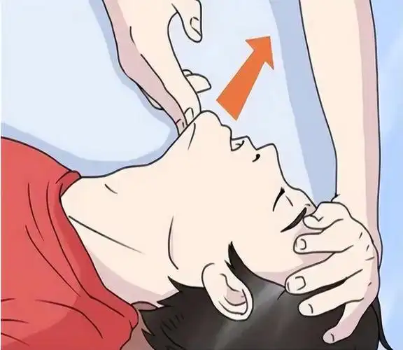 口对口人工呼吸该如何做?医生讲解