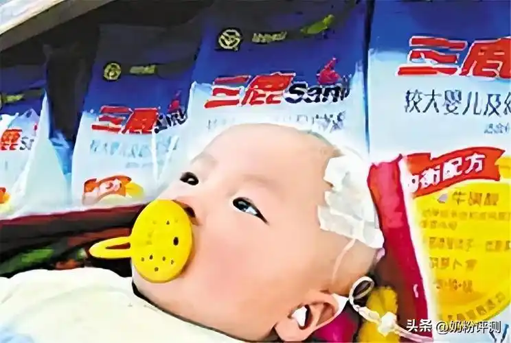 但是这些大头娃娃在长大后症状也没有消失,大家都知道颅脑畸形是很难