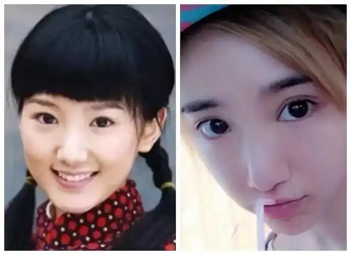 经历了男友劈腿,亲爹讹钱之后,毛晓彤的脸也整的认不出了?