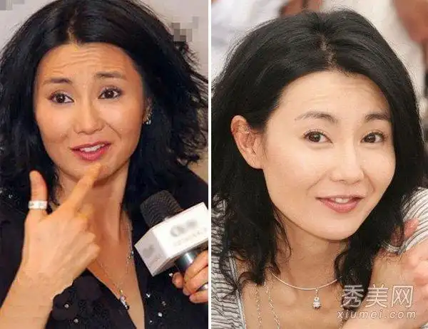 为了保持年轻的容貌,萧蔷这些年整容机构没少去吧!