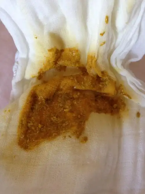 如果母乳不足,宝宝吃不饱会引起拉肚子吗?