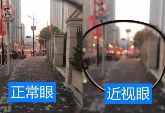 正常眼vs近视眼的世界,看到最后一张照片,我默默放下了手机!