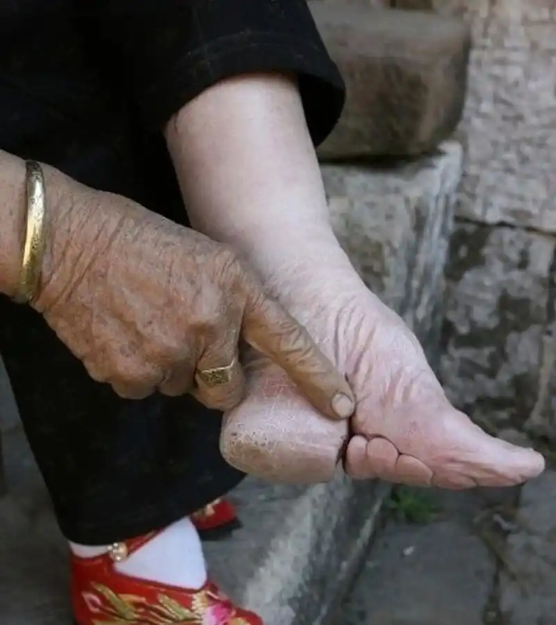 在中国古代,裹小脚似乎是汉族女性的一种普遍现象,不然就嫁不出去人