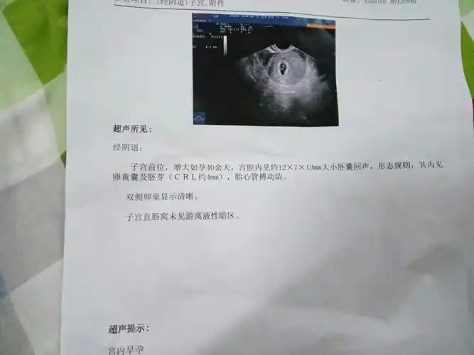 这个结果是不是说我怀孕已经有40天左右呢?