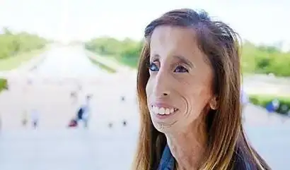 比赛获得女子冠军,被吉尼斯世界纪录组织接受,正式成为全球最丑的女人