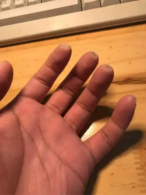 大家弹吉他的手指都是什么样的?