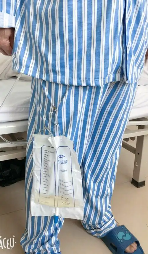 留置尿管的家庭护理,您做对了吗? - 美篇