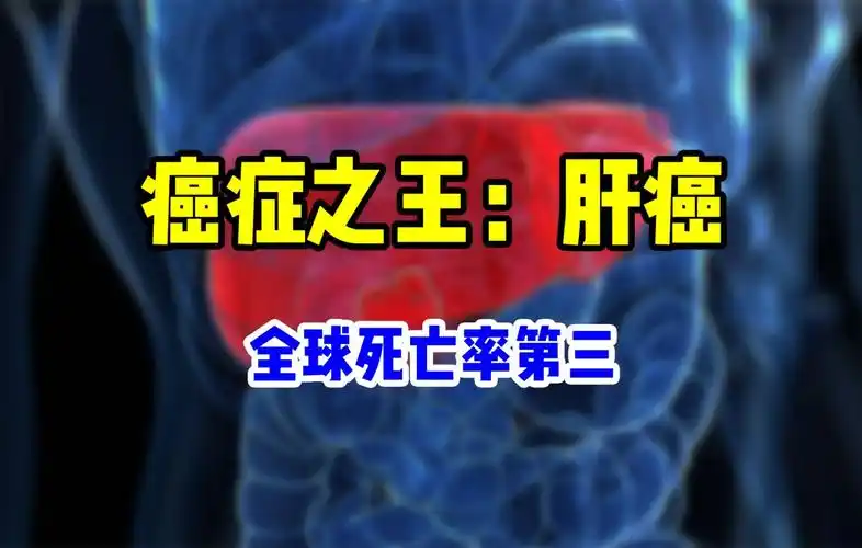 不痛不痒的肝癌怎么成为了死亡率前三的恶疾