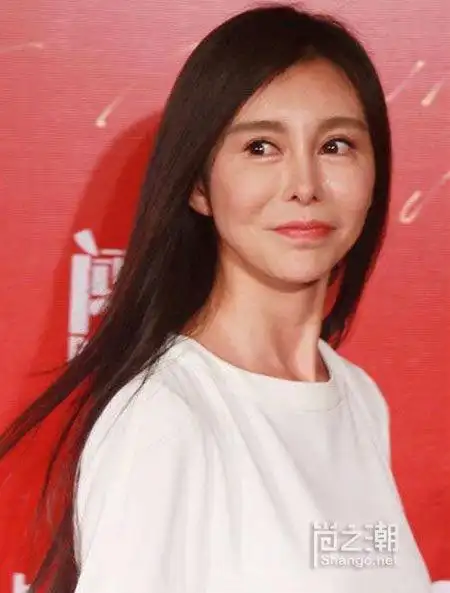 巩新亮整容粉丝哭了 盘点娱乐圈十大整容失败女星