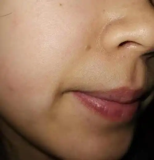 看我,我就是,近年来我的脸部一直都暗沉发黄,以前以为那是黑,没多在意