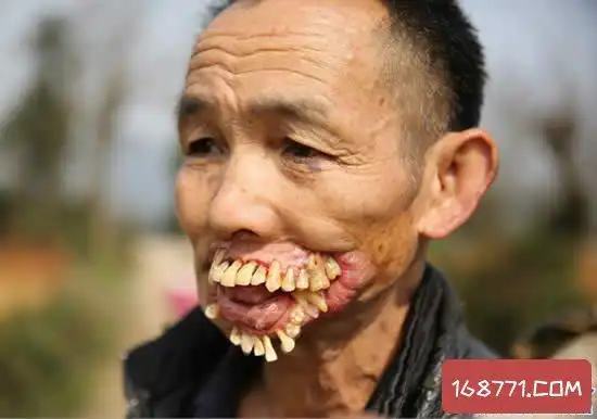 历史上不为人知的十大事实,假牙是死亡士兵的牙齿