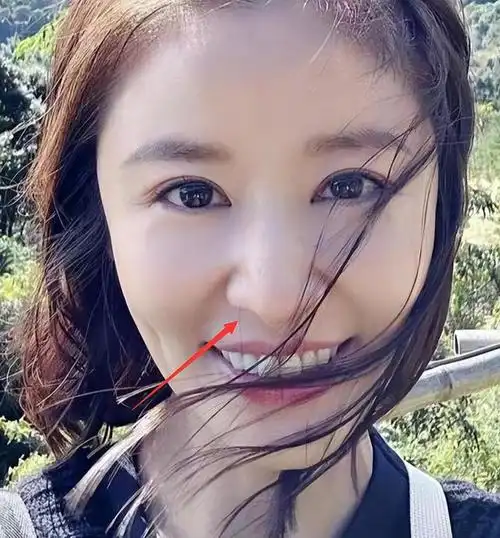 林心如鼻子怪异疑似整容,本人却表示,从出生起就长这样!