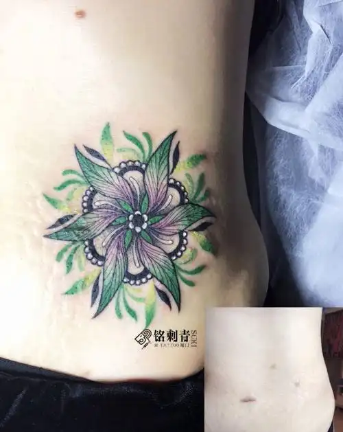 曼陀罗疤痕遮盖纹身图片