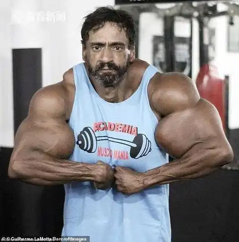 巴西男子冒死注射合成物 皮包骨变成肌肉发达绿巨人