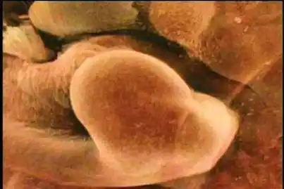 怀孕最初期,胎儿只有针尖般大小;出生时,胎儿一般约有七市斤重.