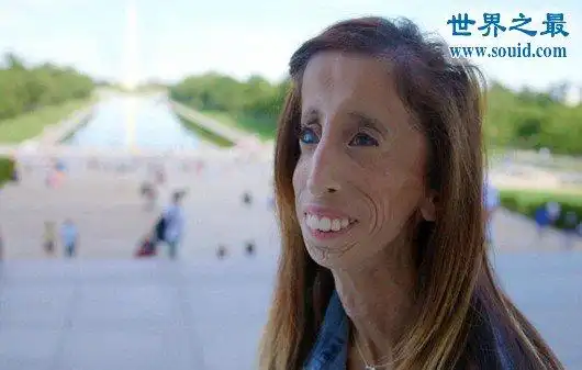 世界上最丑陋的女人,世界上20个最丑的人(怕吐勿看)