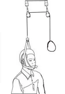 颈椎病病人行牵引治疗必备常识