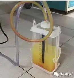 学会胸腔积液鉴别看这篇没错了