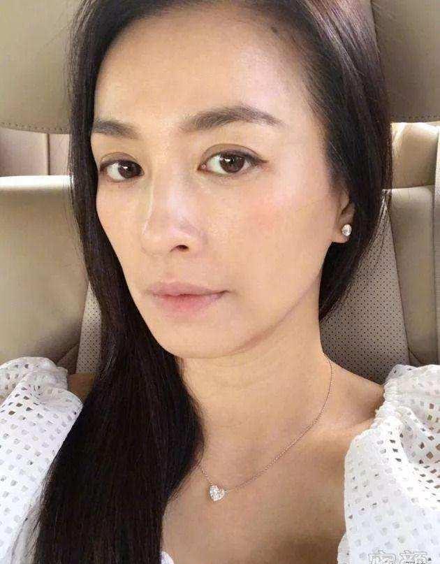 原创张庭近照曝光苍老不已眼角满是皱纹暴露真实年龄