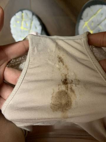 怀孕两个多月了,这两天突然白带呈棕色,是什么原因,有问题吗?