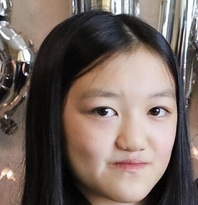 收获多!兔唇会遗传吗"坚不可摧"-第2张图片-龙骑博客