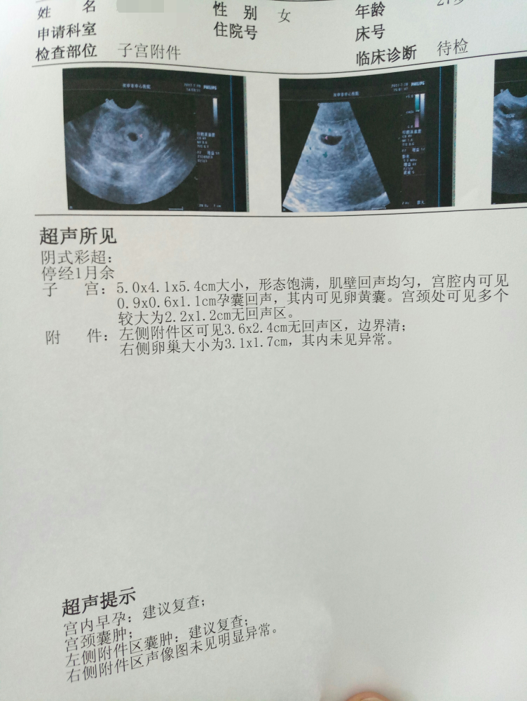 顺利抱娃!孕囊大小对照表"寿比南山"-第2张图片-龙骑博客